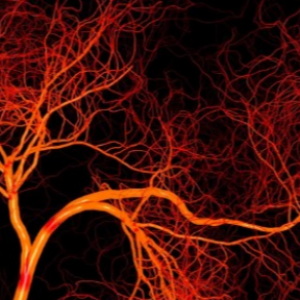 Clearly Visible. Scientists from Samara Have Figured Out How to See Veins Better